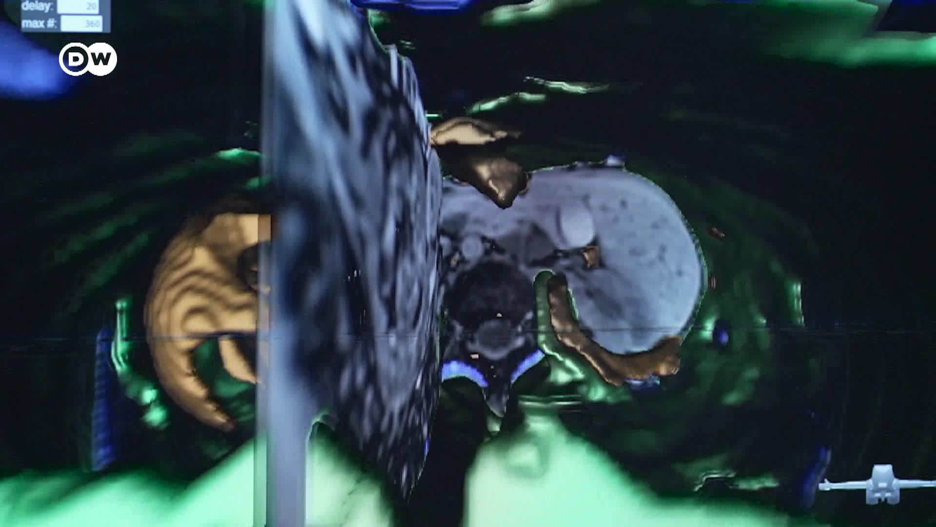 Thumbnail image for Tomorrow Today